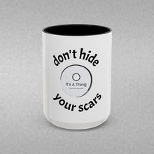 Load image into Gallery viewer, Don’t Hide Your Scars Coffee Mug (15oz)