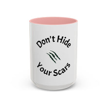 Load image into Gallery viewer, Don’t Hide Your Scars Coffee Mug (15oz)
