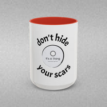 Load image into Gallery viewer, Don’t Hide Your Scars Coffee Mug (15oz)
