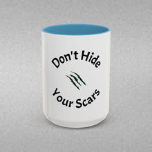 Load image into Gallery viewer, Don’t Hide Your Scars Coffee Mug (15oz)
