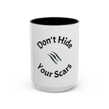 Load image into Gallery viewer, Don’t Hide Your Scars Coffee Mug (15oz)
