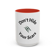 Load image into Gallery viewer, Don’t Hide Your Scars Coffee Mug (15oz)

