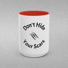 Load image into Gallery viewer, Don’t Hide Your Scars Coffee Mug (15oz)
