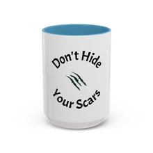 Load image into Gallery viewer, Don’t Hide Your Scars Coffee Mug (15oz)
